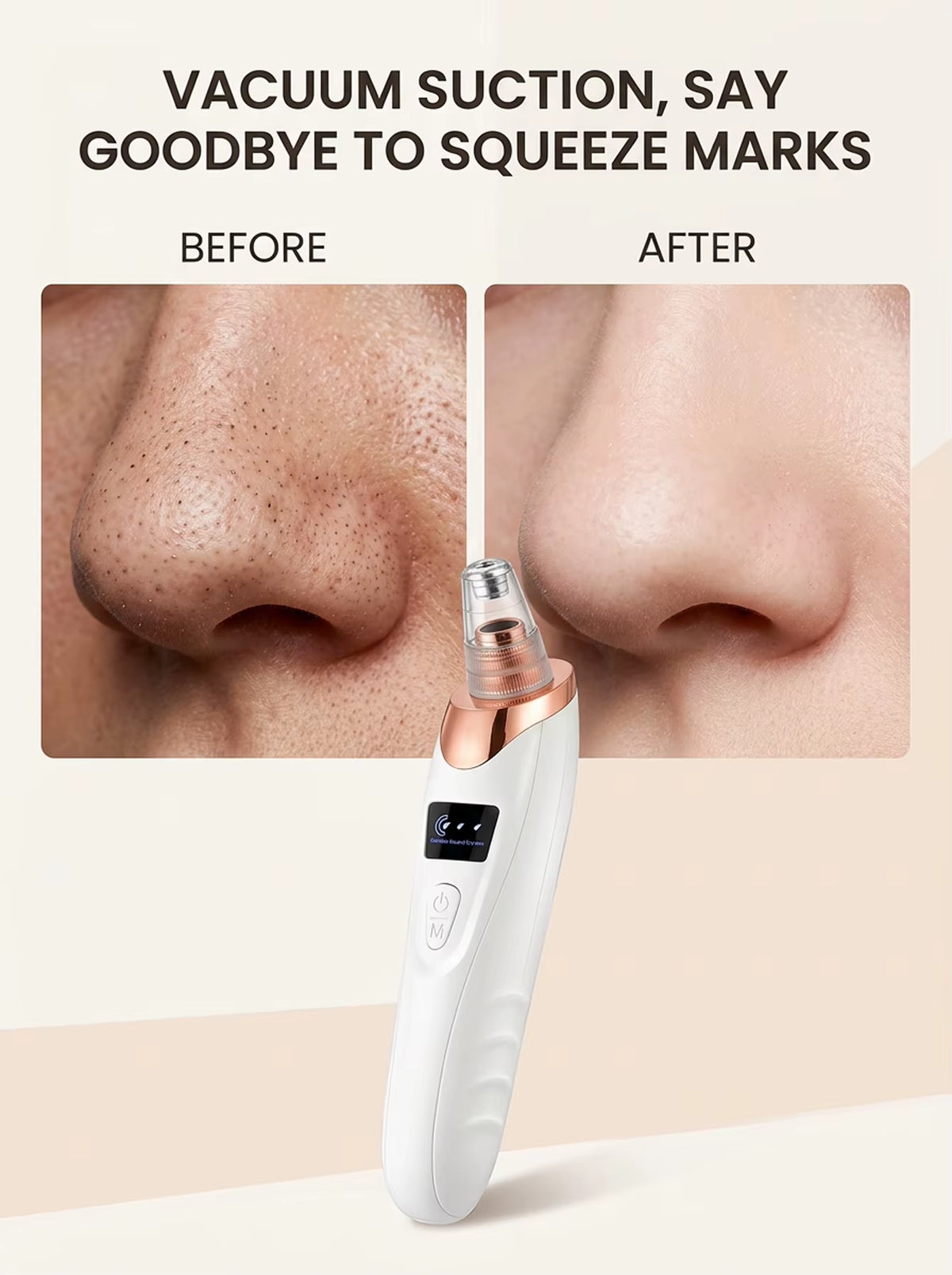 Electric Pore Cleaner & Blackhead Remover