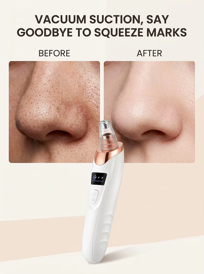 Electric Pore Cleaner & Blackhead Remover