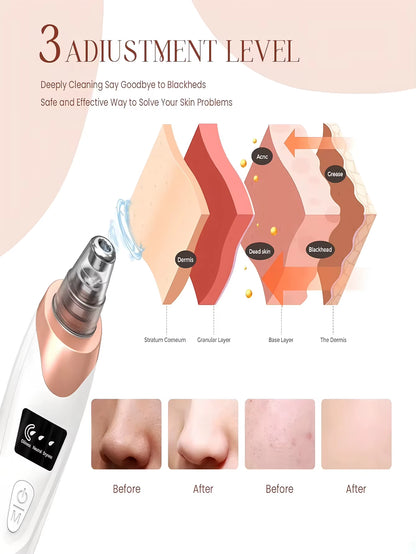 Electric Pore Cleaner & Blackhead Remover